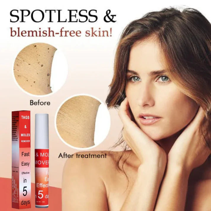 LOVILDS™ Tags & Moles Remover | Clear & Smooth Skin Fast